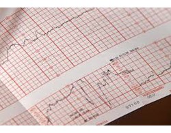 EKG-Karten / EKG-Mappen